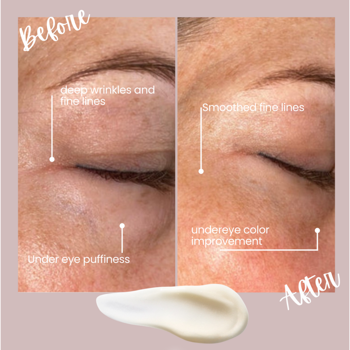 Radiance Renewal Eye Cream + NMF Complex TOPICAL SKIN CLEAN DERMACEUTICALS eye cream in pale beige with NMF complex