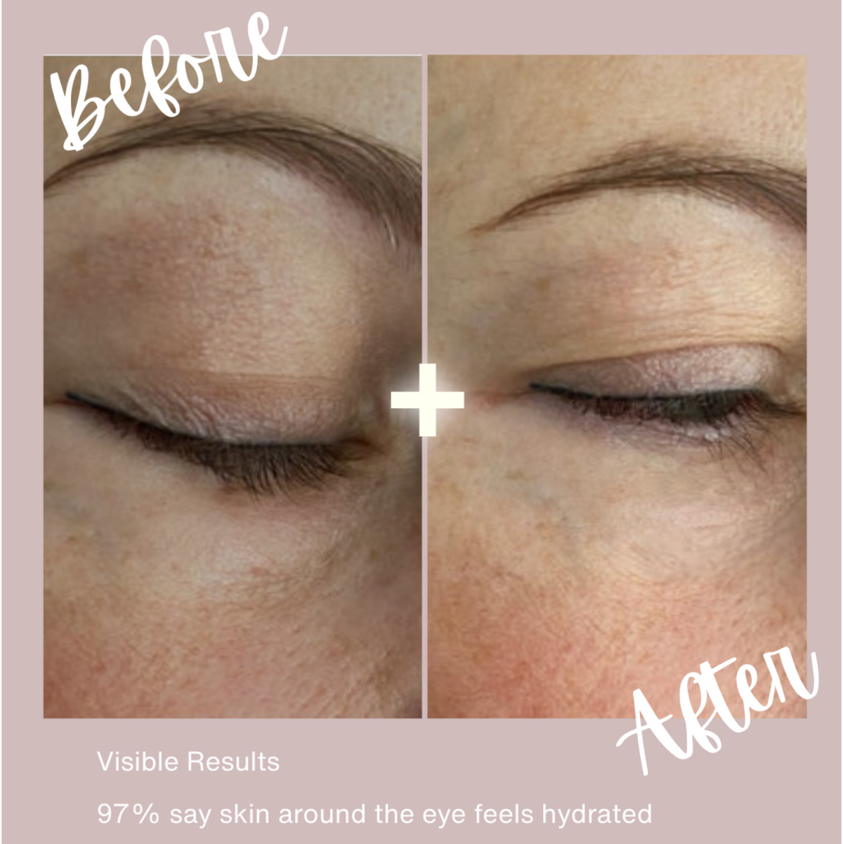 Radiance Renewal Eye Cream + NMF Complex by TOPICAL SKIN CLEAN DERMACEUTICALS eye cream in under-eye before-and-after collage