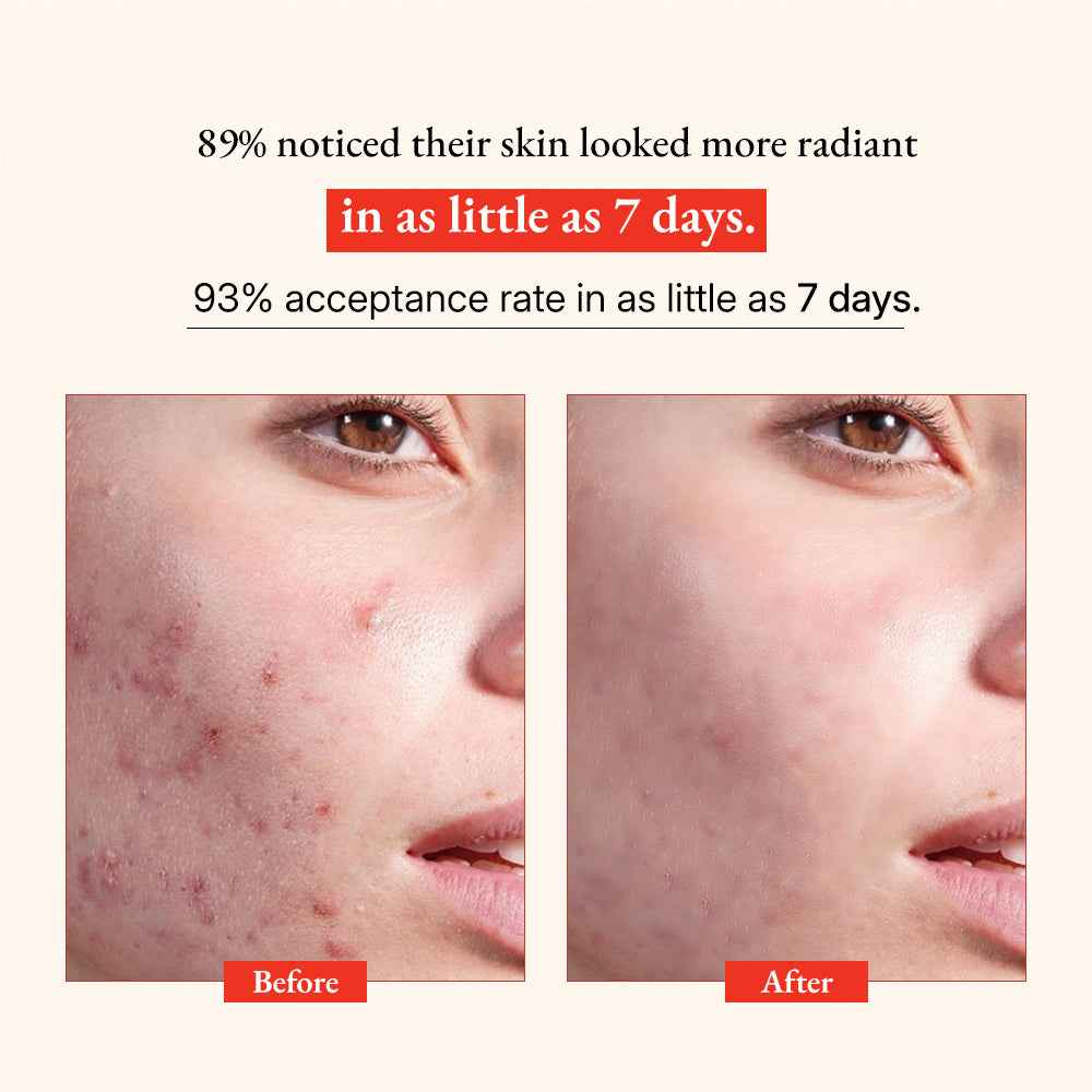 Glow Vitamin C Skin  Brightening Serum
