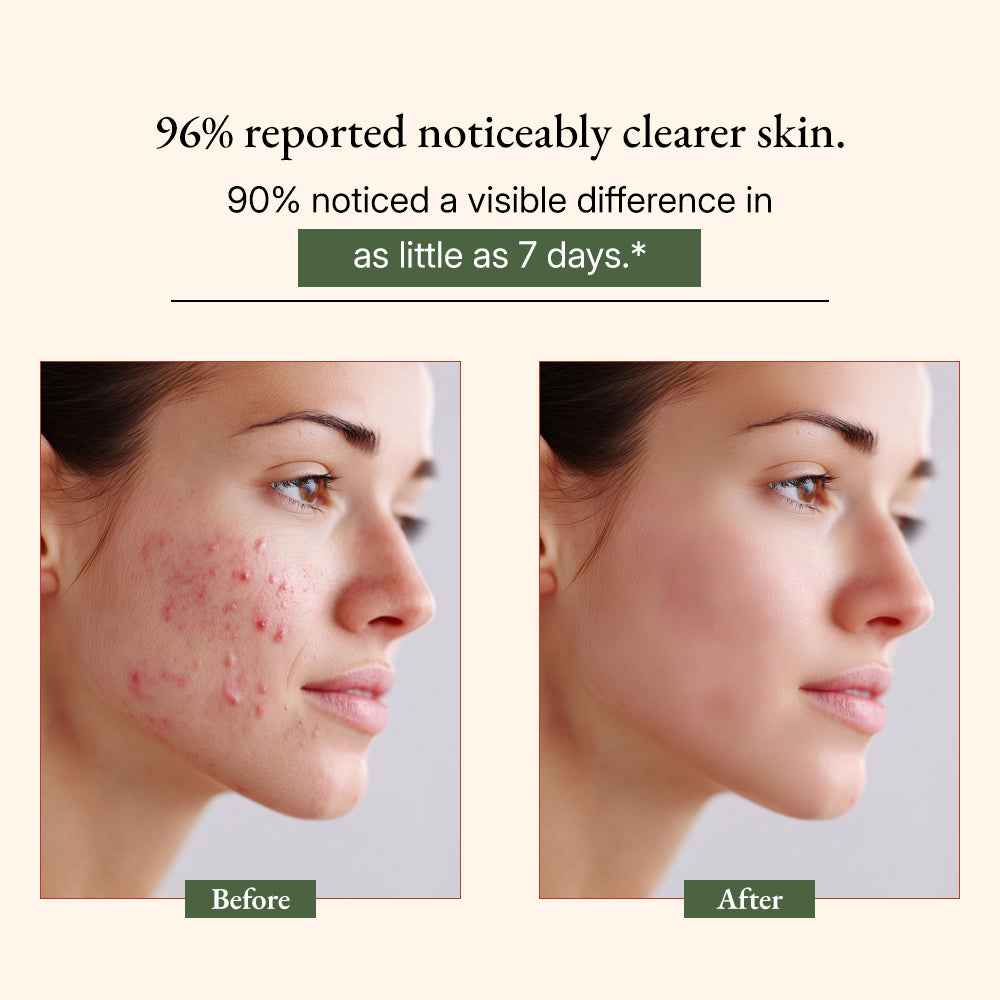 Ayurvedic Neem Cleansing Soap