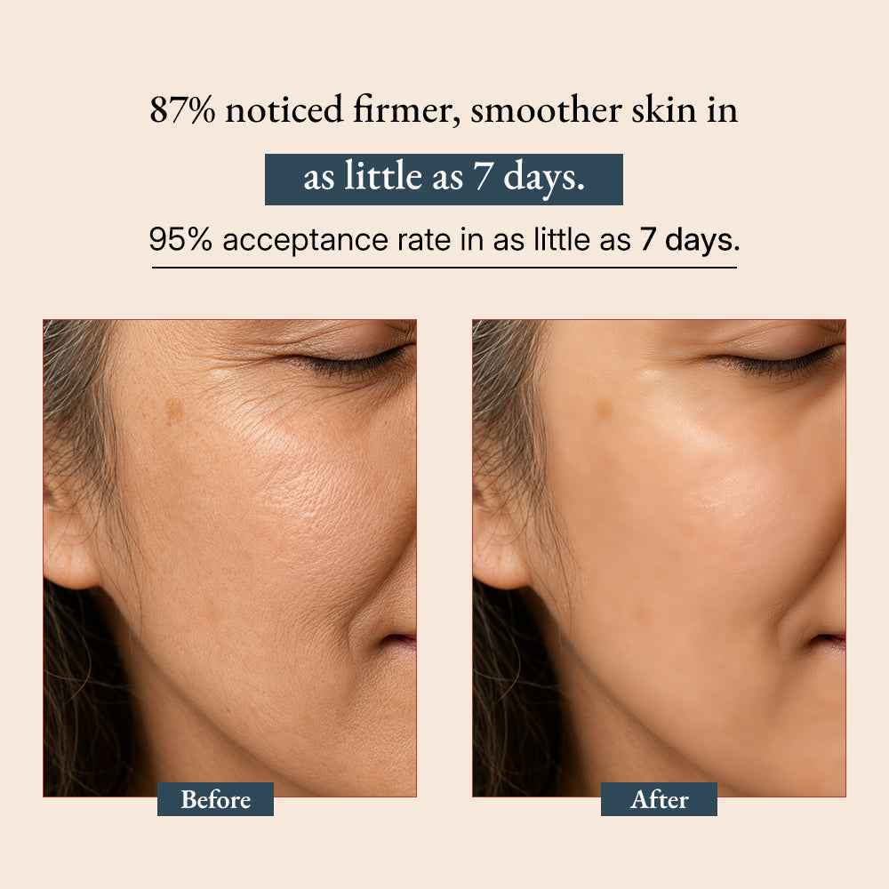 Supercharge Bakuchiol Retinol Serum 1