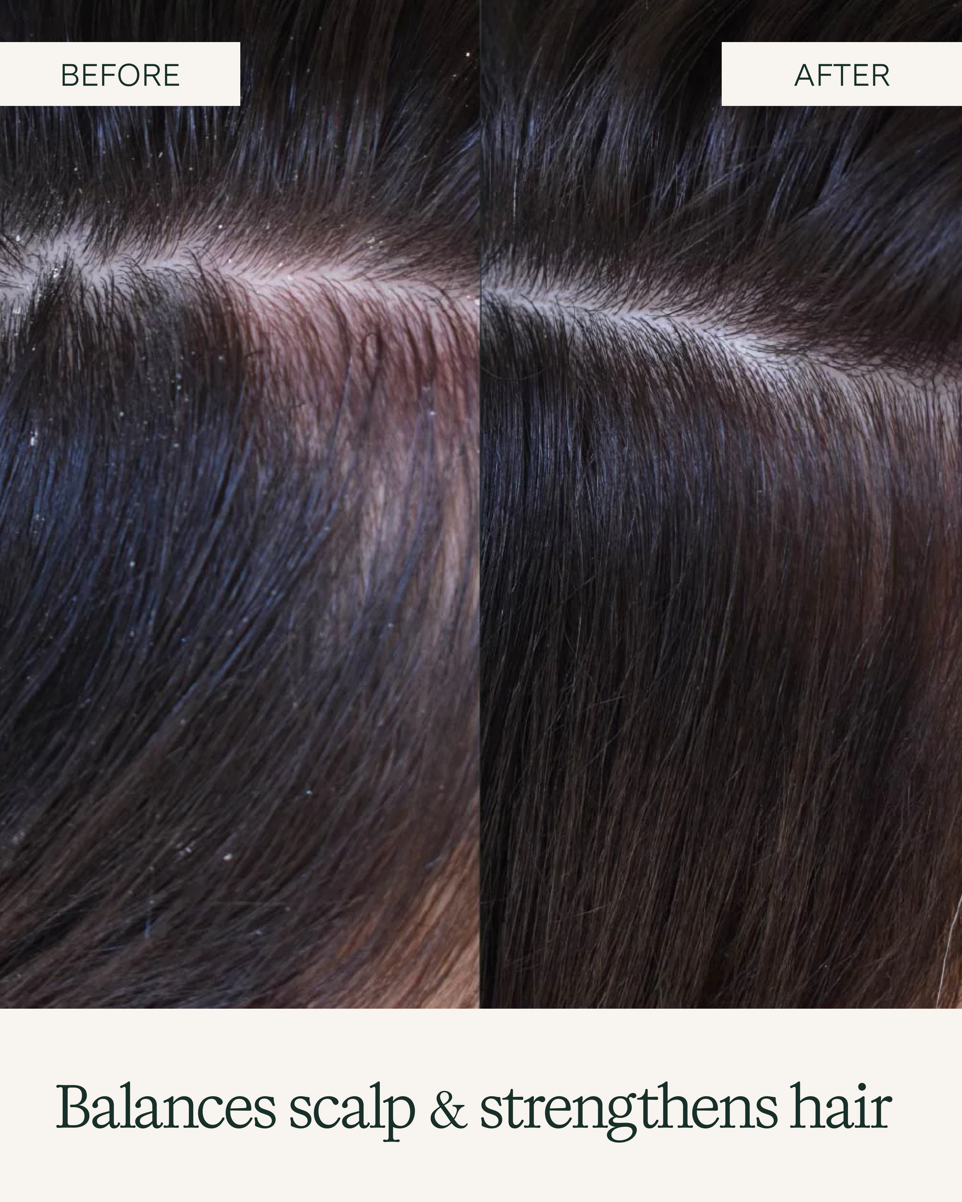 Before and after comparison of hair care product on dark hair, with text 'Balances scalp & strengthens hair'.|variant:93-oz