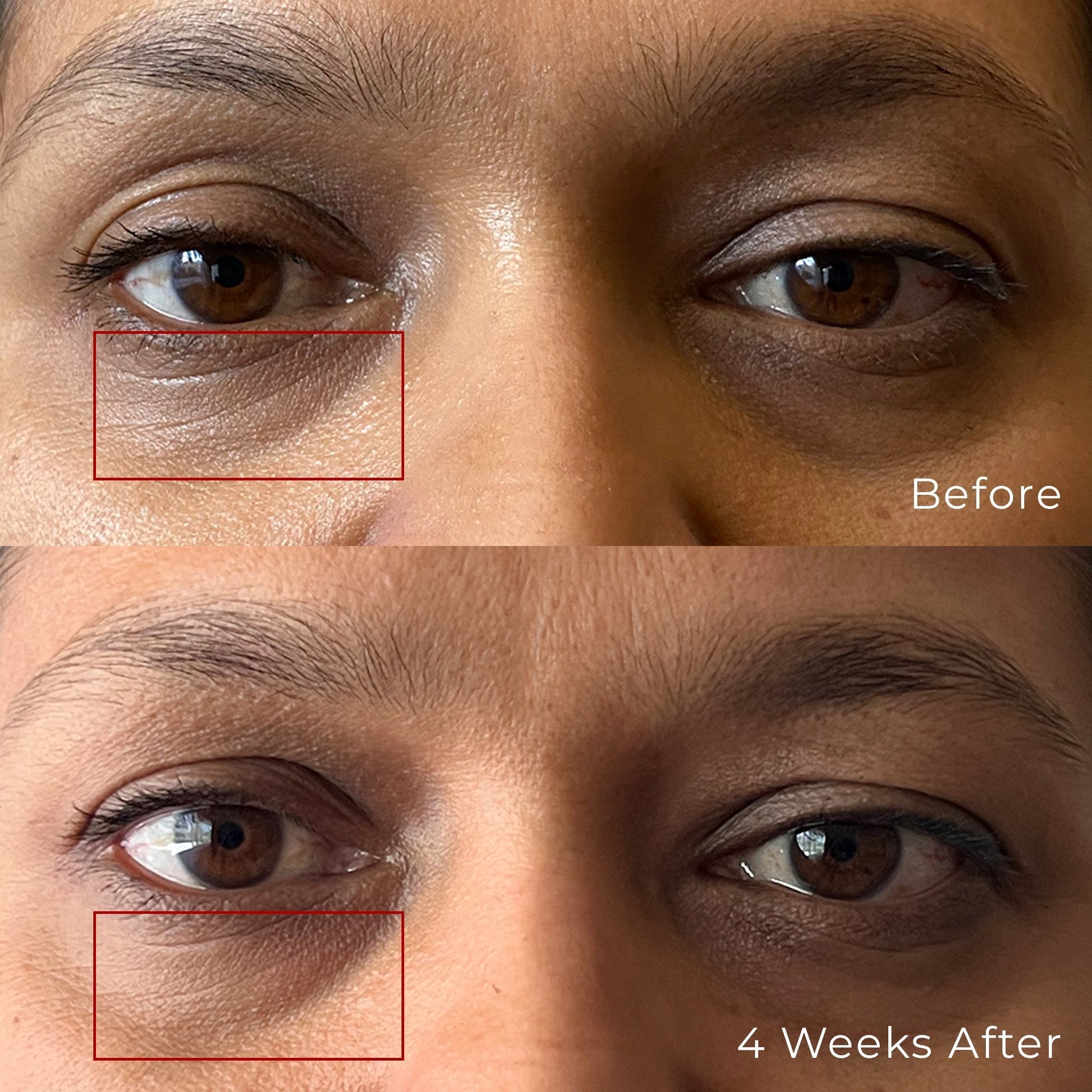 Multi Peptide Hydro Eye Gel Sulina Shop